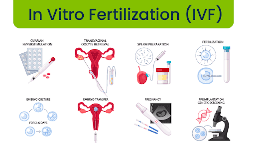 In Vitro Fertilization(IVF)