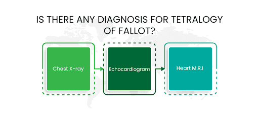 diagnosis for Tetralogy of Fallot